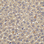 <strong>Figure 6  Immunohistochemistry Validation of IFN-beta in Human Liver Tissue </strong><br> Immunohistochemical analysis of paraffin-embedded human liver tissue using anti-IFN-beta antibody (4243) at 2.5 μg/ml. Tissue was fixed with formaldehyde and blocked with 10% serum for 1 h at RT; antigen retrieval was by heat mediation with a citrate buffer (pH6). Samples were incubated with primary antibody overnight at 4°C. A goat anti-rabbit IgG H&L (HRP) at 1/250 was used as secondary. Counter stained with Hematoxylin.