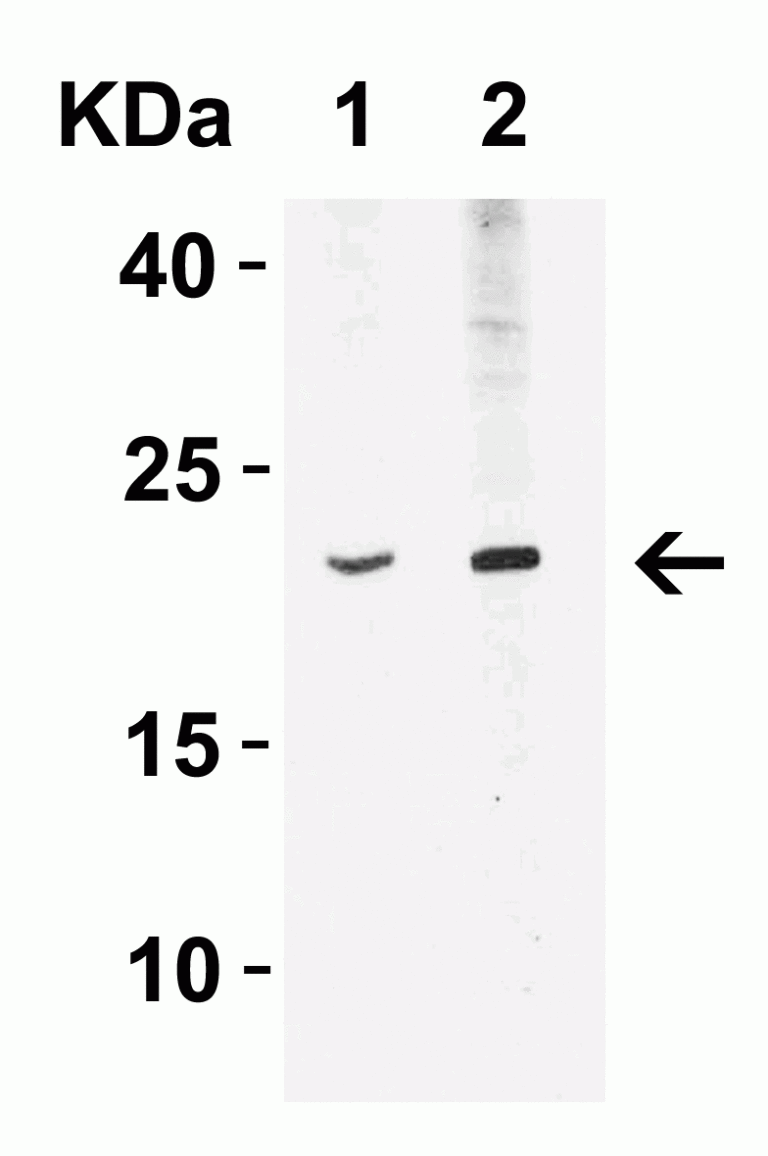 IFN-beta Antibody