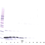 To detect Human IFN-gamma by Western Blot analysis this antibody can be used at a concentration of 0.20-0.40 ug/ml. When used in conjunction with compatible secondary reagents, the detection limit for recombinant Human IFN-gamma is 1.0-3.0 ng/lane, under non-reducing conditions.