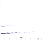 To detect Rat IFN-gamma by Western Blot analysis this antibody can be used at a concentration of 0.1-0.2 ug/ml. When used in conjunction with compatible secondary reagents, the detection limit for recombinant Rat IFN-gamma is 1.5-3.0 ng/lane, under either reducing or non-reducing conditions.