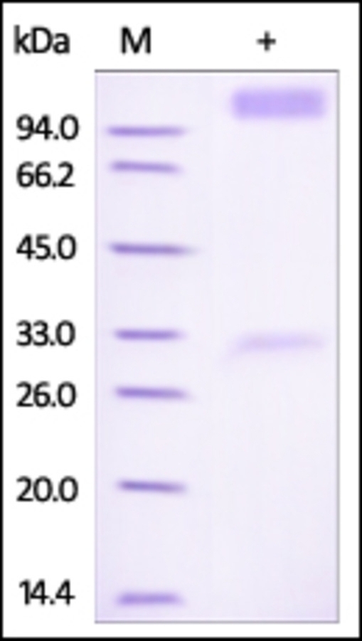 IFNAR 1 Recombinant Protein
