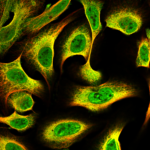 This antibody stained U-2 OS and U-251 MG cells.  The primary antibody was incubated at 2.0 mg/ml overnight at 4°C followed by a fluorescent labeled secondary antibody.  Optimal concentrations and conditions may vary.   Information and photo are courtesy of the Cell Profiling group, SciLifeLab Stockholm.