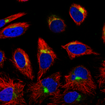 This antibody stained HeLa and U-251 MG cells.  The primary antibody was incubated at 2.0 mg/ml overnight at 4°C followed by a fluorescent labeled secondary antibody.   Optimal concentrations and conditions may vary.  Information and photo are courtesy of the Cell Profiling group, SciLifeLab Stockholm.