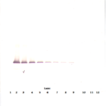 To detect hIGF-BP7 by Western Blot analysis this antibody can be used at a concentration of 0.1 - 0.2 ug/ml. Used in conjunction with compatible secondary reagents the detection limit for recombinant hIGF-BP7 is 1.5 - 3.0 ng/lane, under either reducing or non-reducing conditions.