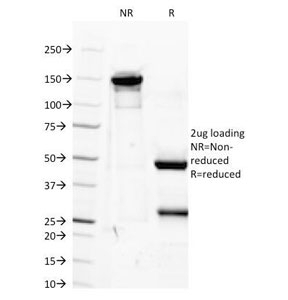 IGF1 Antibody [M23]