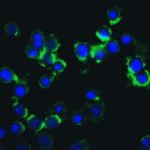 <strong>Figure 6 Immunofluorescence Validation of IKK epsilon in HeLa Cells</strong><br>Immunofluorescent analysis of 4% paraformaldehyde-fixed HeLa cells labeling IKK epsilon with 2329 at 20 μg/mL, followed by goat anti-rabbit IgG secondary antibody at 1/500 dilution (green) and DAPI staining (blue).