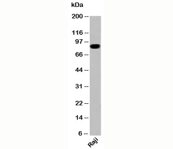 IKKb Antibody [IKB355]