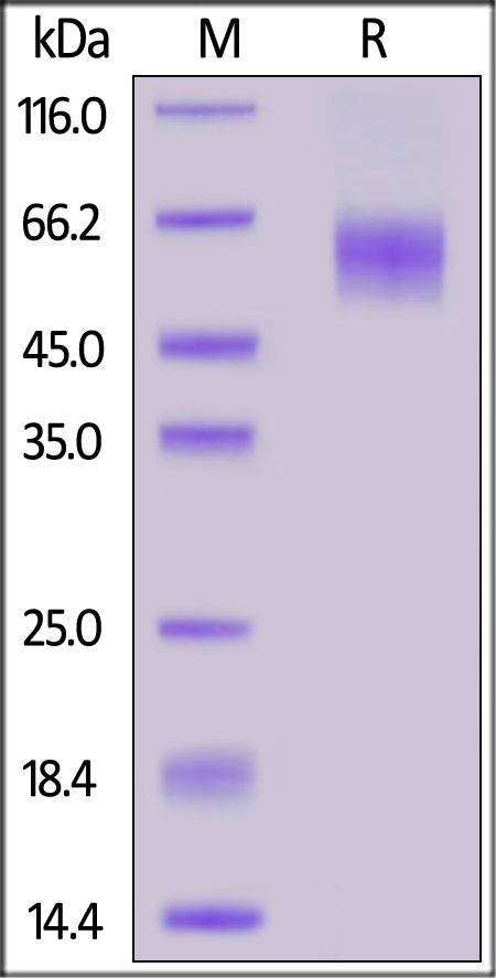IL-1 Rrp2 / IL-1 R6 Recombinant Protein