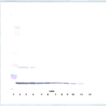 To detect hIL-10 by Western Blot analysis this antibody can be used at a concentration of 0.1 - 0.2 ug/ml. Used in conjunction with compatible secondary reagents the detection limit for recombinant hIL-10 is 1.5 - 3.0 ng/lane, under either reducing or non-reducing conditions.