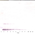 To detect Rat IL-10 by Western Blot analysis this antibody can be used at a concentration of 0.1-0.2 ug/ml. Used in conjunction with compatible secondary reagents the detection limit for recombinant Rat IL-10 is 1.5-3.0 ng/lane, under either reducing or non-reducing conditions.