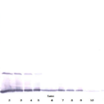 To detect hIL-13 by Western Blot analysis this antibody can be used at a concentration of 0.1 - 0.2 ug/ml. Used in conjunction with compatible secondary reagents the detection limit for recombinant hIL-13 is 1.5 - 3.0 ng/lane, under either reducing or non-reducing conditions.
