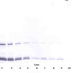 To detect hIL-16 by Western Blot analysis this antibody can be used at a concentration of 0.1 - 0.2 ug/ml. Used in conjunction with compatible secondary reagents the detection limit for recombinant hIL-16 is 1.5-3.0 ng/lane, under either reducing or non-reducing conditions.