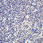 <strong>Figure 8 Immunohistochemistry Validation of IL-17 in Human Tonsil Tissue </strong><br> Immunohistochemical analysis of paraffin-embedded human tonsil tissue using anti-IL-17 antibody (4887) at 5 μg/mL. Tissue was fixed with formaldehyde and blocked with 10% serum for 1 h at RT; antigen retrieval was by heat mediation with a citrate buffer (pH6). Samples were incubated with primary antibody overnight at 4° C. A goat anti-rabbit IgG H&L (HRP) at 1/250 was used as secondary. Counter stained with Hematoxylin.