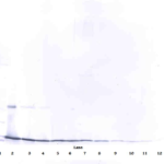To detect hIL-17A by Western Blot analysis this antibody can be used at a concentration of 0.1 - 0.2 ug/ml. Used in conjunction with compatible secondary reagents the detection limit for recombinant hIL-17A is 1.5 - 3.0 ng/lane, under either reducing or non-reducing conditions.