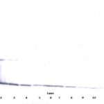 To detect hIL-17A by Western Blot analysis this antibody can be used at a concentration of 0.1 - 0.2 ug/ml. Used in conjunction with compatible secondary reagents the detection limit for recombinant hIL-17A is 1.5 - 3.0 ng/lane, under either reducing or non-reducing conditions.