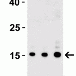<strong>Figure 1 Western Blot Validation with Recombinant Protein</strong><br>Loading: 30 ng of human IL-17 recombinant protein per lane.Antibodies: IL-17 4887, 1h incubation at RT  in 5% NFDM/TBST.Secondary: Goat anti-rabbit IgG HRP conjugate at 1:10000 dilution.Lane 1: 0.125 μg/mLLane 2: 0.25 μg/mLLane 3: 0.5 μg/mL