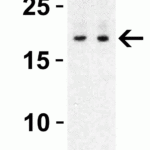 <strong>Figure 2 Western Blot Validation with Human Spleen </strong><br>Loading: 10 μg of lysates per lane.Antibodies: IL-17 4887, 1h incubation at RT in 5% NFDM/TBST.Secondary: Goat anti-rabbit IgG HRP conjugate at 1:10000 dilution.Exposure: 1 minLane 1: 1 μg/mL Lane 2: 2 μg/mL