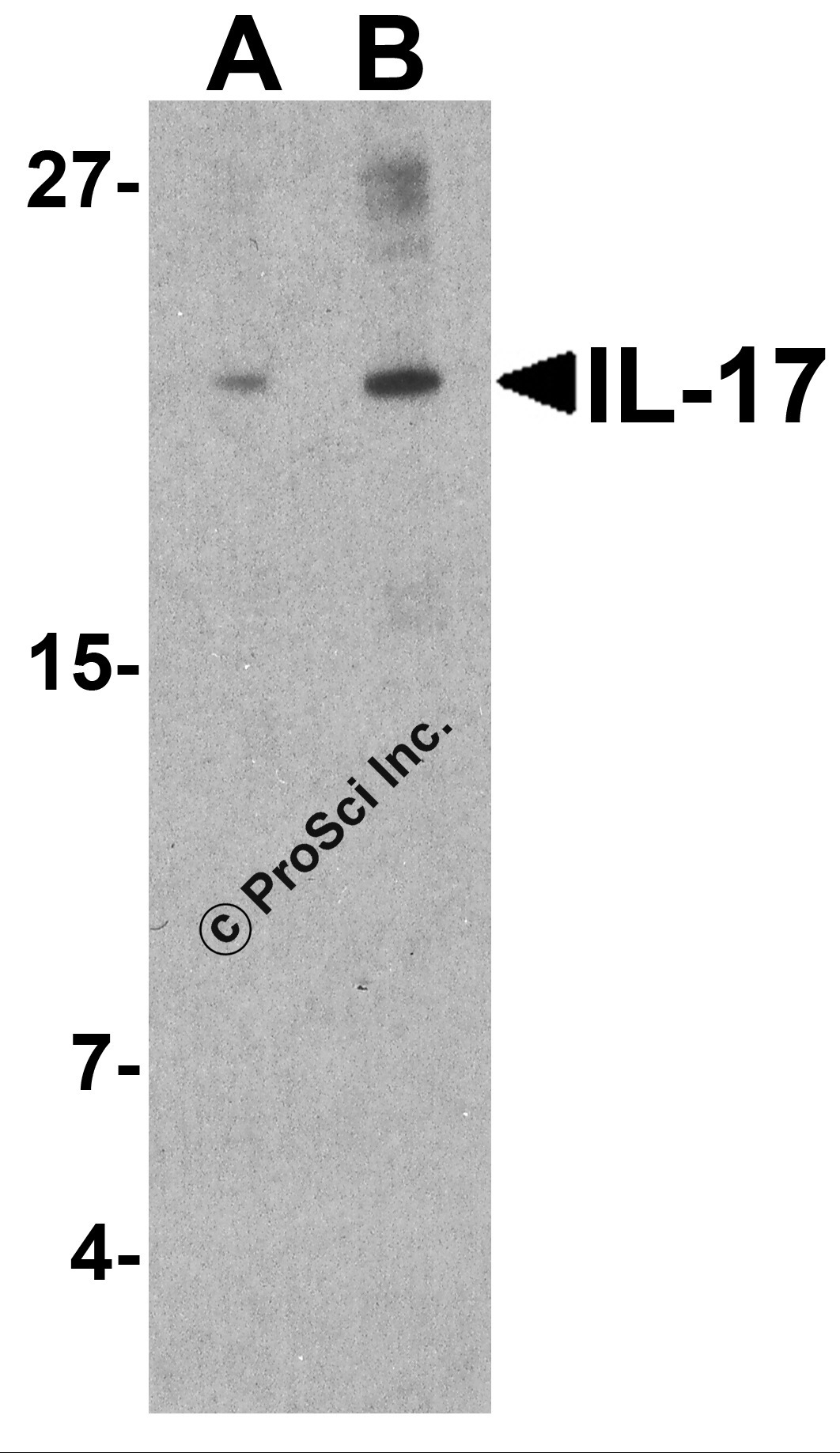 IL-17 Antibody