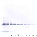 To detect hIL-17A by Western Blot analysis this antibody can be used at a concentration of 0.1 - 0.2 ug/ml. Used in conjunction with compatible secondary reagents the detection limit for recombinant hIL-17A is 1.5 - 3.0 ng/lane, under either reducing or non-reducing conditions.