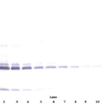 To detect hIL-17A by Western Blot analysis this antibody can be used at a concentration of 0.1 - 0.2 ug/ml. Used in conjunction with compatible secondary reagents the detection limit for recombinant hIL-17A is 1.5 - 3.0 ng/lane, under either reducing or non-reducing conditions.