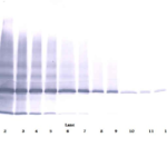 To detect Human IL-17E by Western Blot analysis this antibody can be used at a concentration of 0.1 - 0.2 ug/ml.  When used in conjunction with compatible secondary reagents the detection limit for recombinant Human IL-17E is 1.5 - 3.0 ng/lane, under either reducing or non-reducing conditions.