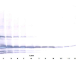 To detect Human IL-17E by Western Blot analysis this antibody can be used at a concentration of 0.1 - 0.2 ug/ml.nbsp; When used in conjunction with compatible secondary reagents the detection limit for recombinant Human IL-17E is 1.5 - 3.0 ng/lane, under either reducing or non-reducing conditions.