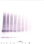 To detect hIL-17F by Western Blot analysis this antibody can be used at a concentration of 0.1 - 0.2 ug/ml. Used in conjunction with compatible secondary reagents the detection limit for recombinant hIL-17F is 1.5 - 3.0 ng/lane, under either reducing or non-reducing conditions.