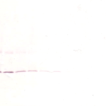 To detect Rat IL-1-beta by Western Blot analysis this antibody can be used at a concentration of 0.1-0.2 ug/ml. When used in conjunction with compatible secondary reagents, the detection limit for recombinant Rat IL-1-beta is 1.5-3.0 ng/lane, under either reducing or non-reducing conditions.