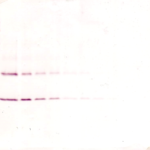 To detect Rat IL-1-beta by Western Blot analysis this antibody can be used at a concentration of 0.1-0.2 ug/ml. When used in conjunction with compatible secondary reagents, the detection limit for recombinant Rat IL-1-beta is 1.5-3.0 ng/lane, under either reducing or non-reducing conditions.