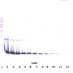 To detect Human IL-1RA by Western Blot analysis this antibody can be used at a concentration of 0.1 - 0.2 ug/ml. Used in conjunction with compatible secondary reagents the detection limit for recombinant Human IL-1RA is 1.5 - 3.0 ng/lane, under either reducing or non-reducing conditions.