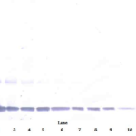 To detect hIL-1-alpha by Western Blot analysis this antibody can be used at a concentration of 0.1 - 0.2 ug/ml. Used in conjunction with compatible secondary reagents the detection limit for recombinant hIL-1-alpha is 1.5 - 3.0 ng/lane, under either reducing or non-reducing conditions.