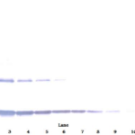 To detect Rat IL-1-alpha by Western Blot analysis this antibody can be used at a concentration of 0.1 - 0.2 ug/ml. Used in conjunction with compatible secondary reagents the detection limit for recombinant Rat IL-1-alpha is 1.5 - 3.0 ng/lane, under either reducing or non-reducing conditions.