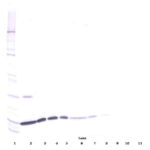 To detect hIL-2 by Western Blot analysis this antibody can be used at a concentration of 0.1 - 0.2 ug/ml. Used in conjunction with compatible secondary reagents the detection limit for recombinant hIL-2 is 1.5 - 3.0 ng/lane, under either reducing or non-reducing conditions.