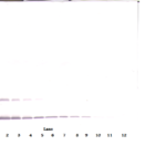 To detect hIL-2 by Western Blot analysis this antibody can be used at a concentration of 0.1 - 0.2 ug/ml. Used in conjunction with compatible secondary reagents the detection limit for recombinant hIL-2 is 1.5 - 3.0 ng/lane, under either reducing or non-reducing conditions.
