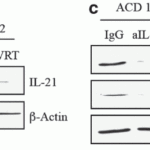 <strong>Figure 7  Regulation of IL-21 expresssion in duodenal biopsies of two patients with active Celiac disease (ACD) (Sarra et al., 2013) </strong><br>(b) shows IL-21 expression levels treated with dimethyl sulfoxide (DMSO) or wortmannin (WRT). (c) shows IL-21 expression levels with the inhibition of IL-15 antibody (aIL-15).  IgG isotype was used as a control.Both WB show IL-21 expression decreased with the treatment with WRT or the inhibition of IL-15 antibody.