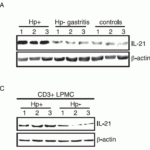 <strong>Figure  8 Induced Expression Validation of IL-21 expresssion in patients with Helicobacter Pylori (Hp) (Caruso et al., 2007) </strong><br>(A) shows IL-21 expression levels from biopsies of patients with Hp infection and without Hp infection (n=3).(C) shows IL-21 expression levels in CD3+LPMC cells from Hp-positive and Hp-negative patients (n=3).Both WB show IL-21 expression increased in patients with Hp infection.