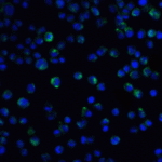 Immunofluorescence of IL21R in A431 cells with IL 21 Receptor antibody at 20 μg/mL.<br><br>Green: IL-21 Receptor Antibody (2469) <br> Blue: DAPI staining