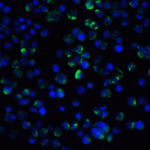 Immunofluorescence of IL-21 Receptor in A431 cells with IL-21 Receptor antibody at 20 μg/ml.<br><br>Green: IL-21 Receptor Antibody (2471) <br> Blue: DAPI staining
