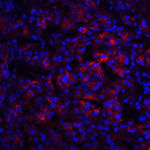 <strong>Figure 6 Immunofluorescence Validation of IL-23 in Human Pancreas Tissue</strong><br>Immunofluorescent analysis of 4% paraformaldehyde-fixed human pancreas tissue labeling IL-23 with 3793 at 20 μg/mL, followed by goat anti-rabbit IgG secondary antibody at 1/500 dilution (red) and DAPI staining (blue).