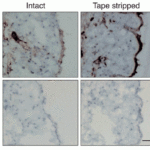 <strong>Figure 6  Induced Expression Validation of IL-23 in Mouse Keratinocytes of Epidermis (Yoon  et al., 2016) </strong><br>The expression of IL-23 protein induced by tape stripping was detected by immunohistochemical analysis of mouse's skin with anti-IL-23 antibodies. Skin sections from the mouse exhibited epidermis staining positive for IL-23 expression 6 hr after tape stripping. Staining with an isotype-matched irrelevant antibody (Ctrl IgG) was used as a negative control.