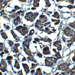 <strong>Figure 7 Immunohistochemistry Validation of IL-23 in Human Pancreas Tissue </strong><br> Immunohistochemical analysis of paraffin-embedded human pancreas tissue using anti-IL-23 antibody (3793) at 5 μg/ml. Tissue was fixed with formaldehyde and blocked with 10% serum for 1 h at RT; antigen retrieval was by heat mediation with a citrate buffer (pH6). Samples were incubated with primary antibody overnight at 4° C. A goat anti-rabbit IgG H&L (HRP) at 1/250 was used as secondary. Counter stained with Hematoxylin.