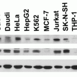 <strong>Figure 2 Independent Antibody Validation (IAV) via Protein Expression Profile in Cell Lines</strong><br>Loading: 15 µg of lysates per lane.Antibodies: IL-27 3797 (4 μg/mL), IL-27 3799 (4 μg/mL), and beta-actin (1 μg/mL),  1h incubation at RT  in 5% NFDM/TBST.Secondary: Goat anti-rabbit IgG HRP conjugate at 1:10000 dilution.