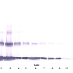 To detect hIL-31 by Western Blot analysis this antibody can be used at a concentration of 0.1 - 0.2 ug/ml. Used in conjunction with compatible secondary reagents the detection limit for recombinant hIL-31 is 1.5 - 3.0 ng/lane, under either reducing or non-reducing conditions.