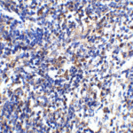 <strong>Figure 5 Immunohistochemistry Validation of IL-32 in Mouse Spleen Tissue </strong><br> Immunohistochemical analysis of paraffin-embedded mouse spleen tissue using anti-IL-32 antibody (3749) at 2 μg/ml. Tissue was fixed with formaldehyde and blocked with 10% serum for 1 h at RT; antigen retrieval was by heat mediation with a citrate buffer (pH6). Samples were incubated with primary antibody overnight at 4°C. A goat anti-rabbit IgG H&L (HRP) at 1/250 was used as secondary. Counter stained with Hematoxylin.