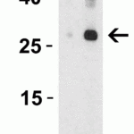 <strong>Figure 2 Western Blot Validation in Human Spleen Lysate, showing two isoforms of IL-32</strong><br>Loading: 15 μg of lysates per lane.Antibodies: IL-32, 3749 (lane 1: 2 μg/mL and lane 2: 4 μg/mL), 1h incubation at RT in 5% NFDM/TBST.Secondary: Goat anti-rabbit IgG HRP conjugate at 1:10000 dilution.