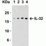 <strong>Figure 1 Western Blot Validation with Recombinant Protein</strong><br>Loading: 30 ng of human IL-32 recombinant protein per lane.Antibodies: IL-32, 3749 (Lane 1: 0.5 μg/mL, Lane 2: 1 μg/mL,  Lane 3: 2 μg/mL and Lane 4: 4 μg/mL), 1h incubation at RT  in 5% NFDM/TBST.Secondary: Goat anti-rabbit IgG HRP conjugate at 1:10000 dilution.Observed at around 17kD.