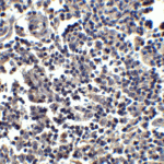 <strong>Figure 6 Immunohistochemistry Validation of IL-33 in Human Lymph Node </strong><br>Immunohistochemical analysis of paraffin-embedded human lymph node tissue using anti-IL-33 antibody (4273) at 2.5 μg/ml. Tissue was fixed with formaldehyde and blocked with 10% serum for 1 h at RT; antigen retrieval was by heat mediation with a citrate buffer (pH6). Samples were incubated with primary antibody overnight at 4°C. A goat anti-rabbit IgG H&L (HRP) at 1/250 was used as secondary. Counter stained with Hematoxylin.