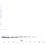 To detect Rat IL-3-beta by Western Blot analysis this antibody can be used at a concentration of 0.1 - 0.2 ug/ml. Used in conjunction with compatible secondary reagents the detection limit for recombinant Rat IL-3-beta is 1.5 - 3.0 ng/lane, under either reducing or non-reducing conditions.