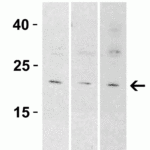 <strong>Figure 3 Western Blot Validation in Tissue and Cell Lines</strong><br>Loading: 15 μg of lysates per lane.Antibodies: IL-9, 7495 (1 µg/mL), 1h incubation at RT in 5% NFDM/TBST.Secondary: Goat anti-rabbit IgG HRP conjugate at 1:10000 dilution.