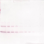 To detect Murine IL-9 by Western Blot analysis this antibody can be used at a concentration of 0.1-0.2 ug/ml. When used in conjunction with compatible secondary reagents, the detection limit for recombinant Murine IL-9 is 1.5-3.0 ng/lane, under either reducing or non-reducing conditions.